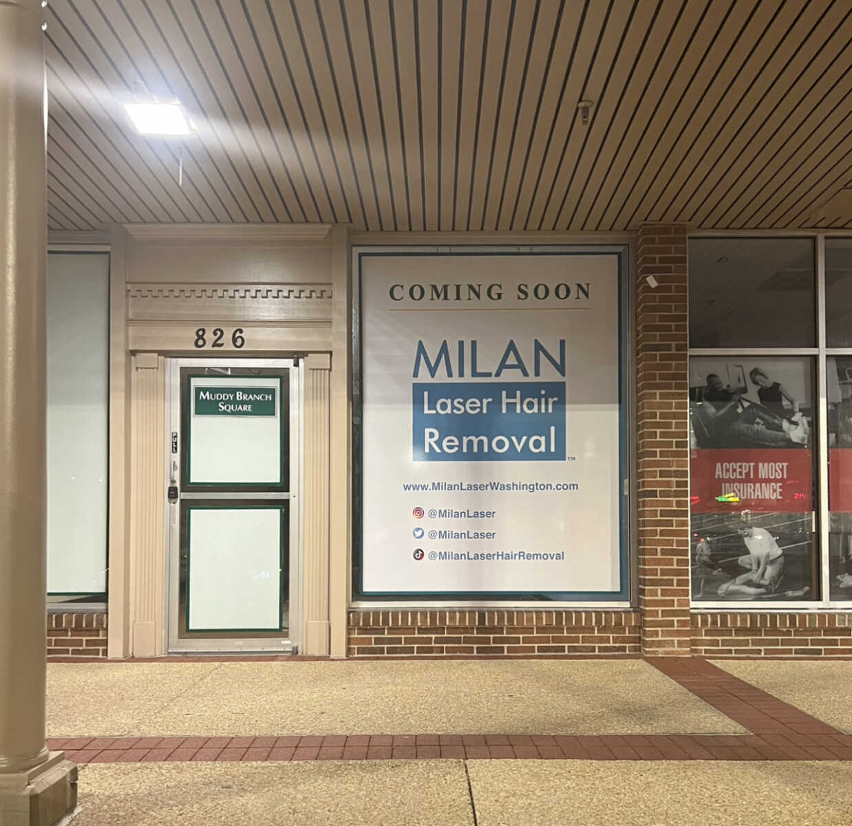 Milan Laser Hair Removal Coming Soon to Muddy Branch Square - The MoCo Show